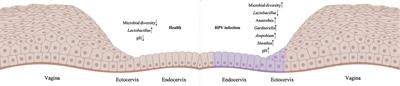 Cervicovaginal Microbiome Factors in Clearance of Human Papillomavirus Infection